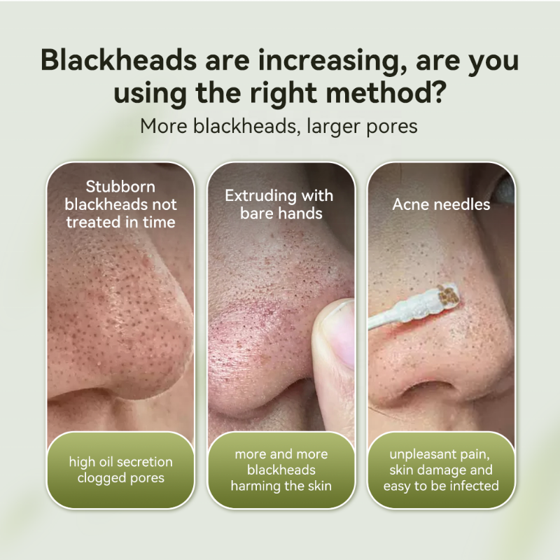 PoreMask 1+1 GRATIS - Diepe Pore Reiniging Blackhead Verwijder Peel-Off Masker