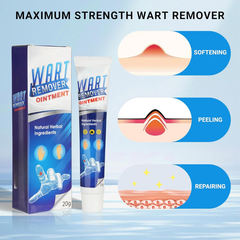 WartRemover 1+1 GRATIS: Veilige Huid Wrat Ointment Verwijderaar