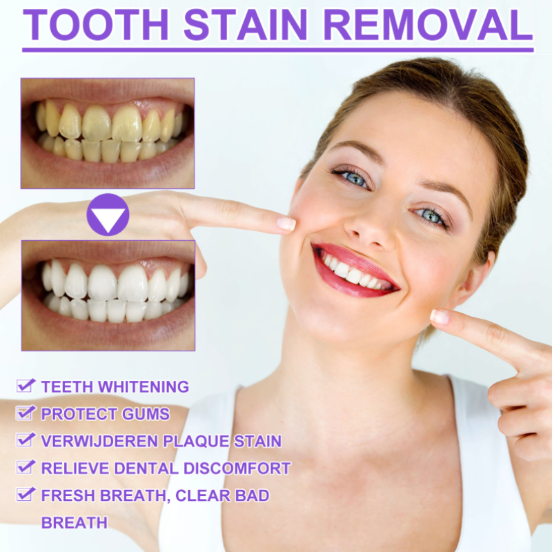 TeethSerum 1+1 GRATIS - Tanden Witmakend En Bescherming Serum