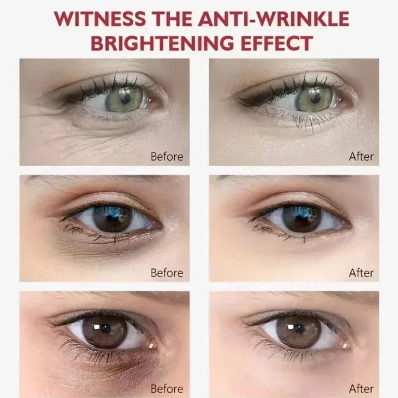 EyeCream 1+1 GRATIS: Hydraterend Verstevigend Anti-Donkere kringen Oog Crème Serum
