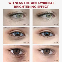 EyeCream 1+1 GRATIS: Hydraterend Verstevigend Anti-Donkere kringen Oog Crème Serum