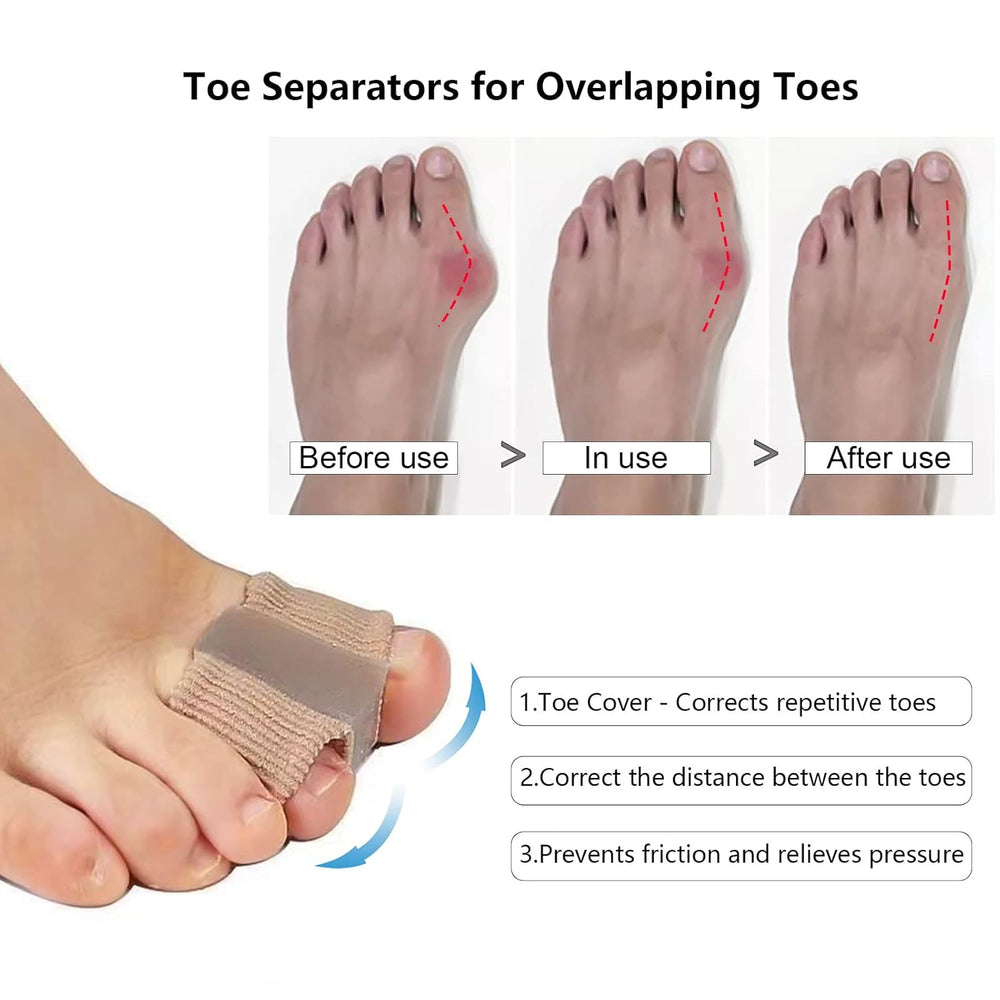 ToeSeparators: Premie Teen Scheiders Voor Comfortabele Teen Uitlijning