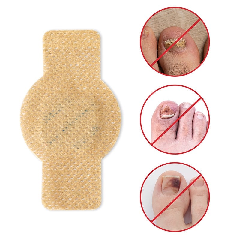 FungalPatch - Antibacterieel Schimmelwerend Patch En Nagelverzorging Pak