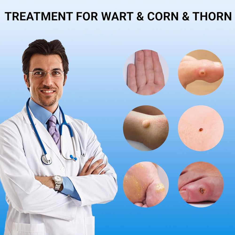 WartRemover 1+1 GRATIS: Veilige Huid Wrat Ointment Verwijderaar