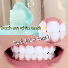 WhiteningToothpaste 1+1 GRATIS: Niacinamide Witmaking En Vlekverwijdering Tandpasta