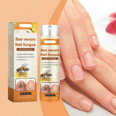 NailSpray 1+1 GRATIS - Gemakkelijk Te Gebruiken Soothing Steun Nagelverzorging Reparatiespray