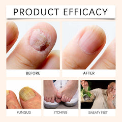 NailSpray 1+1 GRATIS - Gemakkelijk Te Gebruiken Soothing Steun Nagelverzorging Reparatiespray