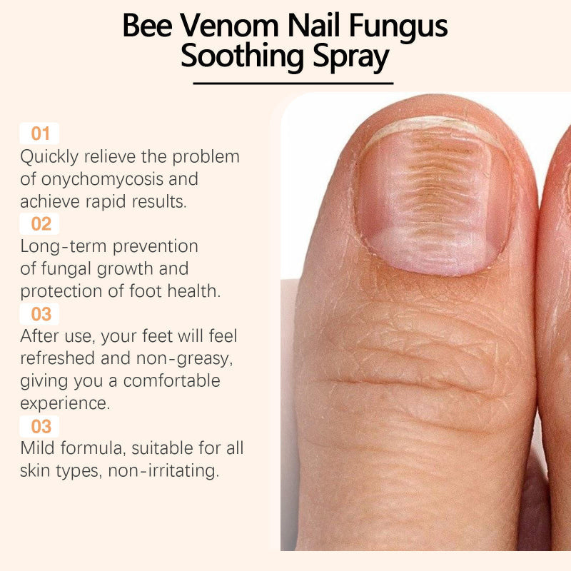 NailSpray 1+1 GRATIS - Gemakkelijk Te Gebruiken Soothing Steun Nagelverzorging Reparatiespray