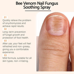 NailSpray 1+1 GRATIS - Gemakkelijk Te Gebruiken Soothing Steun Nagelverzorging Reparatiespray