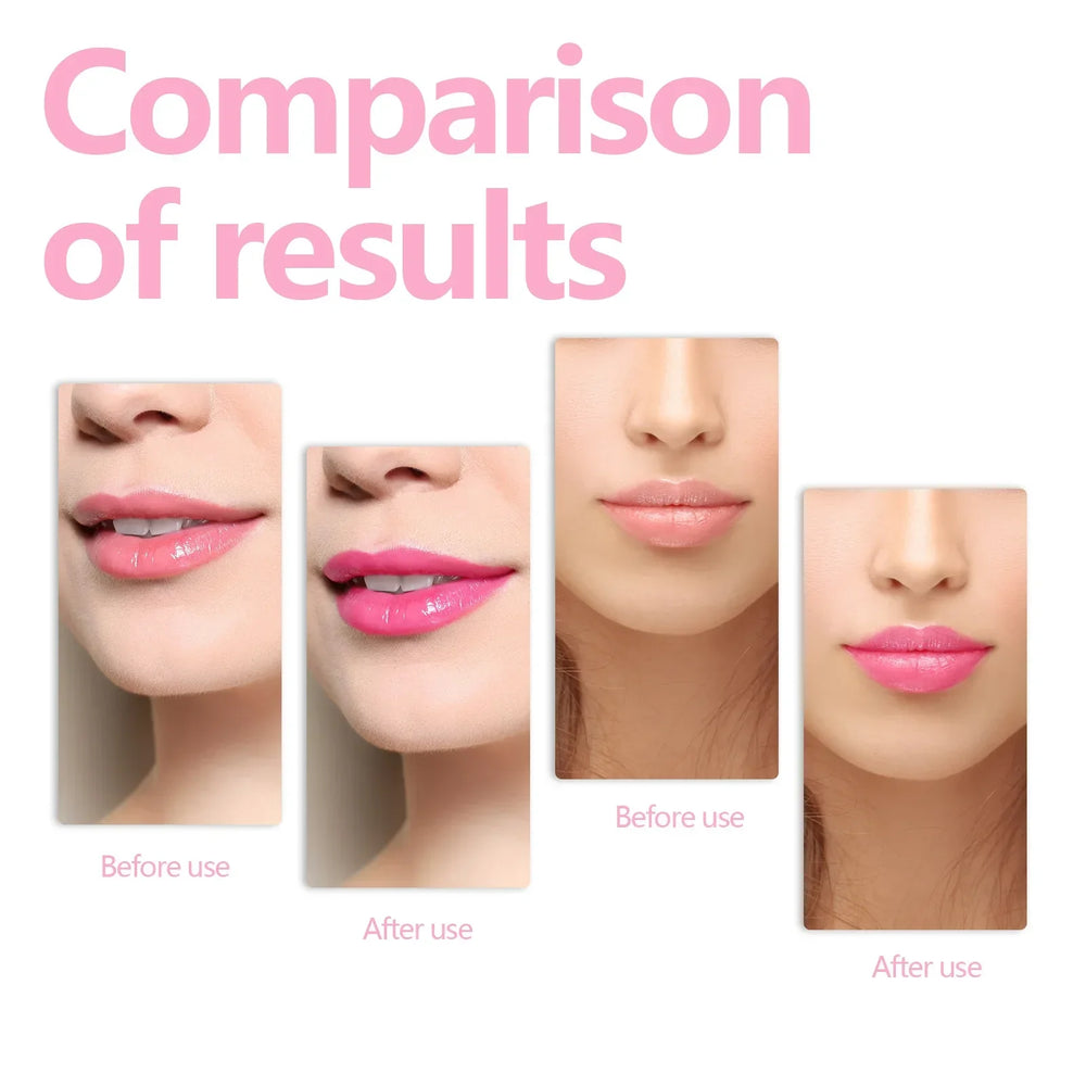 LipOil - Plumping Hydraterende Lip Olie