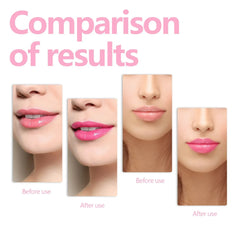 LipOil - Plumping Hydraterende Lip Olie