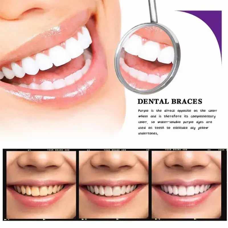 TeethSerum 1+1 GRATIS - Tanden Witmakend En Bescherming Serum