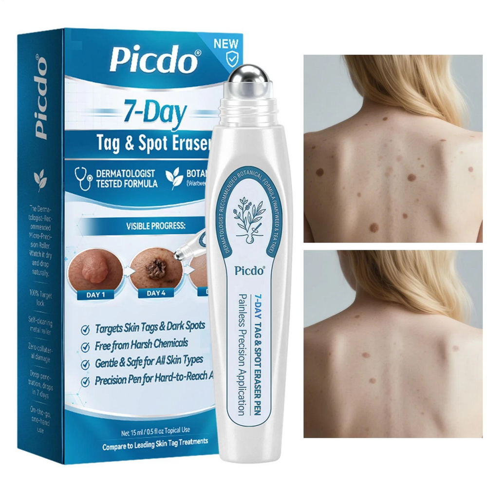 ClearRoller™ 1+1 GRATIS - Geavanceerd Een Heldere Huid Verfijnende Vernieuwing Roller-Serum