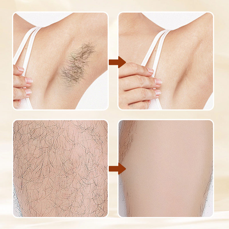 HairErase – Zacht Ontharen Ontharing Crème
