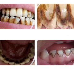 DentalCare – Gemakkelijke 360° Tandverzorging Gereedschapsset Thuis
