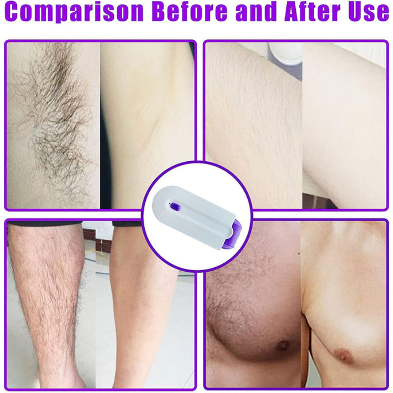 SmoothShaver - Multifunctionele Glad Zachte Pijnloze Haarverwijderingsscheerapparaat